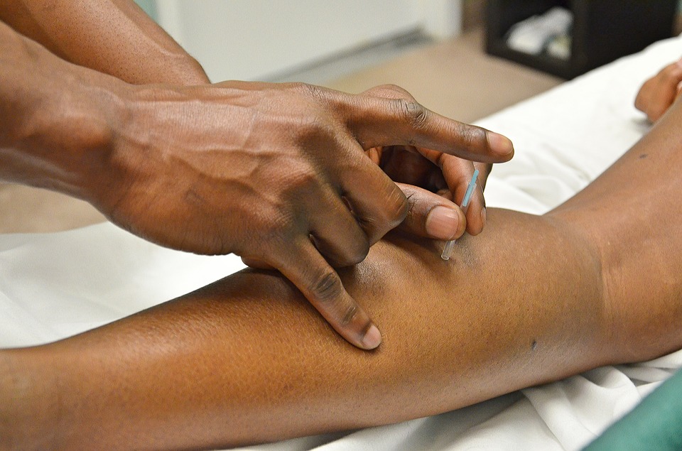 Forebyg dine smerter med akupunktur